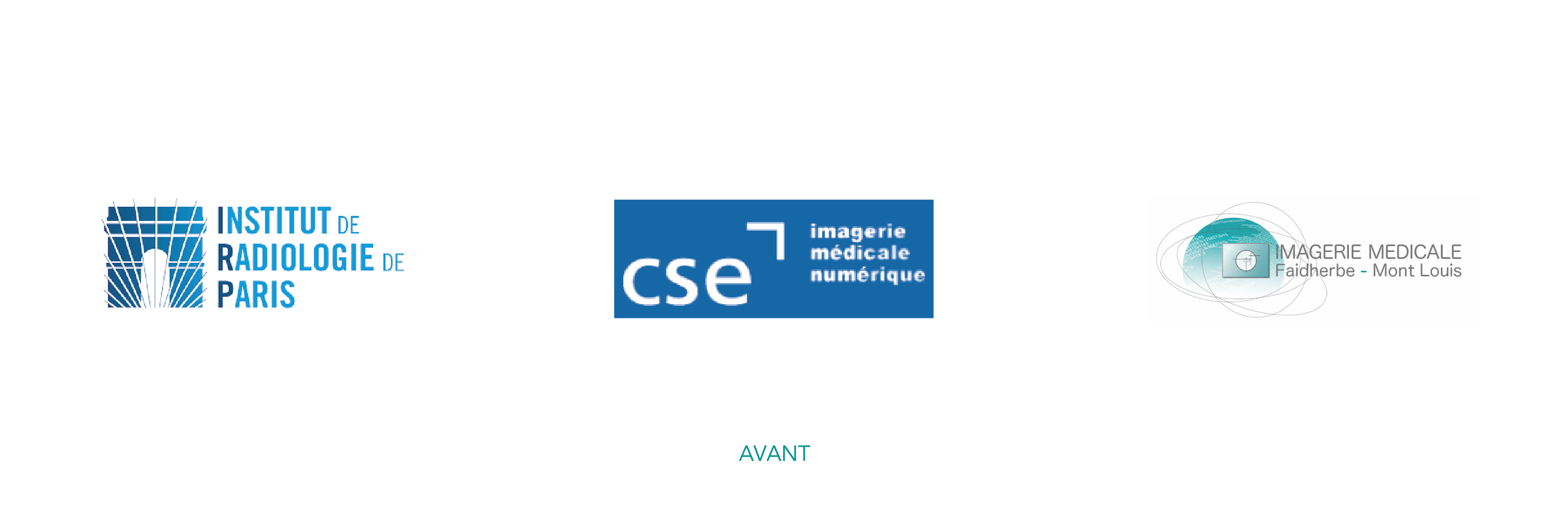 Avant
